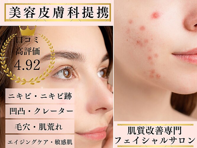 レイ(REI)｜ホットペッパービューティー 