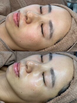 ユーイン 塩尻店(U-in)/ララピールビフォーアフター