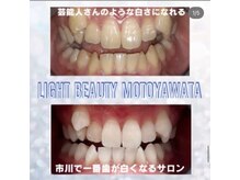 ライトビューティー 本八幡店(LIGHT BEAUTY)/【セルフホワイトニング】