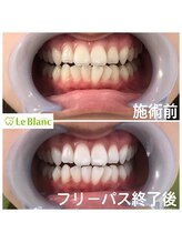 ルブラン 奈良店(Le Blanc)/先日終了致しました。