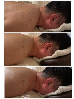 イルソーレ(IL Sole)/ガチガチの肩首もゆるめます