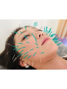 小顔になりたい