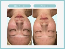 スリムライン 秋田店(The Slim Line)/before→after