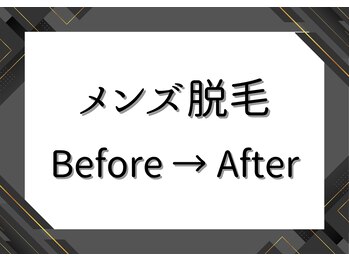 アルゴ 西鉄香椎駅前店(ALGO)/メンズ ビフォーアフター
