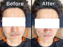 アンフィニ(Infini)