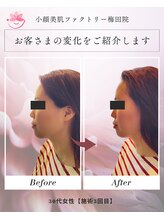 小顔美肌ファクトリー 梅田院/