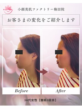 小顔美肌ファクトリー 梅田院/