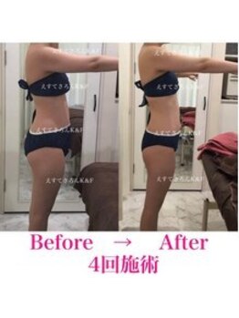 えすてさろん ケイアンドエフ(k&f)/施術結果4回