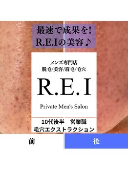 レイ(R.E.I)/毛穴エクストラクション／1回