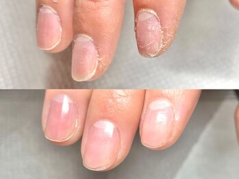 マロル(mal'olu)の写真/【フィルイン込価格】爪が薄い・持ちが悪い・仕上りにこだわりがある方は是非！ケアメニューも人気◎