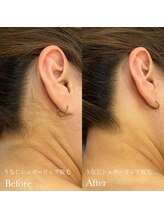 ラピスビューティーサロン(Lapis beauty salon)/後ろ姿美人に♪