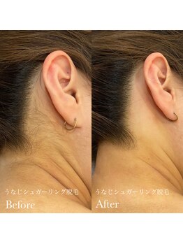 ラピスビューティーサロン(Lapis beauty salon)/後ろ姿美人に♪