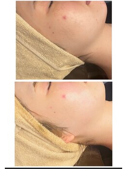 フーレスト アンド フリーリー(Fullest&Freely)/韓国発!最新ララピール