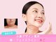 エルビア エステ ドゥ パリ(Elevia Esthe de Paris)の写真/【小顔ドレナージュ】オールハンド×脂肪分解剤でその場でフェイスライン結果出し◎リフトアップ小顔矯正