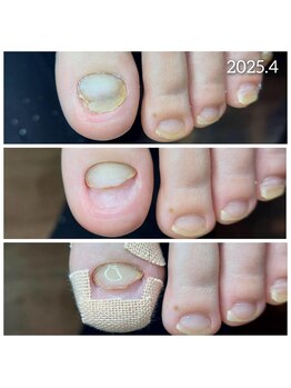 爪切り屋 足楽/