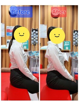 みらい整体院 山形南院/☆Before　After☆