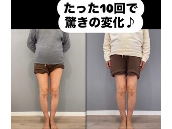 みやび整体院/O脚が気になっていた方