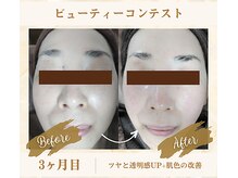 ソフィアパレス 西葛西店/ビューティーコンテストNo2