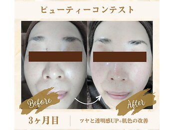 ソフィアパレス 西葛西店/ビューティーコンテストNo2