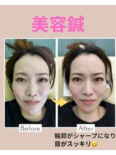 しんご鍼灸整骨院/美容鍼