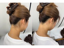 ミース 宮崎店/『うなじ矯正』ビフォーアフター