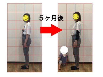 まもる整体サロン 新山口店/20代　産後の腰痛と体型