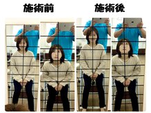 すずらん整体院の雰囲気（before→after【１回でこの効果◎】）