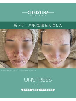 エクラフルール(Eclat Fleur)の写真/通いやすい都度払いで理想の美へ！　無理な勧誘なしで、お得な回数券へ移行もOKです☆