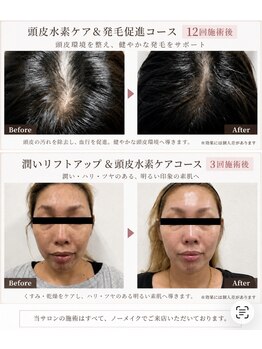 リベルテの写真/自分のペースで通える安心感！都度払いで美しさをサポート、しつこい勧誘は一切なしの快適サロン♪