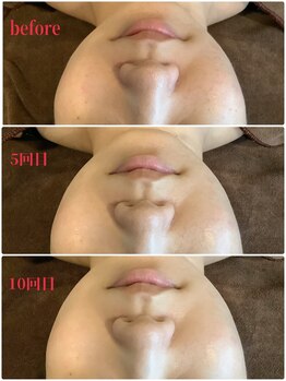 エステティックジュネス(JEUNESSE)/美肌光フェイシャル