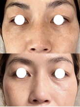 サロンドココリール(salon de cocorire)/Lit を打ち続け一年半後♪