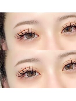 ダイヤモンド リリー(Diamond Lily)/バインドロック