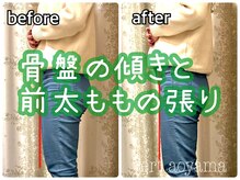 ヴェール 青山(vert)/骨盤矯正ビフォーアフター