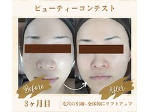 ソフィアパレス 西葛西店/ビューティーコンテストNo3