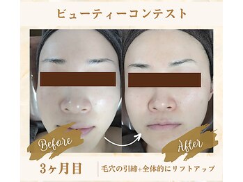 ソフィアパレス 西葛西店/ビューティーコンテストNo3