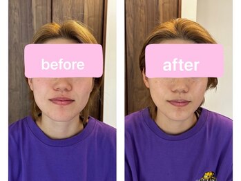 ツナギ 新座(TSUNAGI)/BeforeAfter