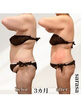 ナチュラル ビューティー スタイル さらさ(Natural Beauty Style)/さらさ痩身プログラム3カ月