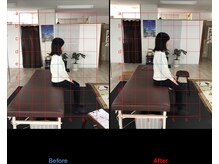 ストレチックス 近江八幡店/身体の硬さから来る肩の痛み撃退