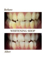 ホワイトニングショップ 四条店/