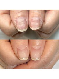 爪の凹凸もお悩み解消!!