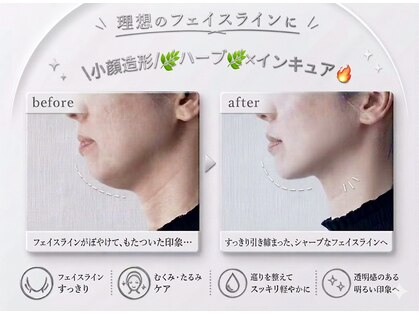 ミロワール ドゥ サピュイェ(MIROIR de Sappuyer)の写真