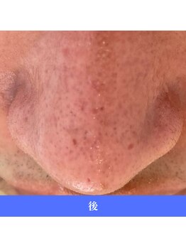 レイ(R.E.I)/一発でとれる！