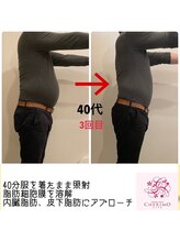 シェリモ(CHERIMO)/温活スリムドーム　3回目　お腹