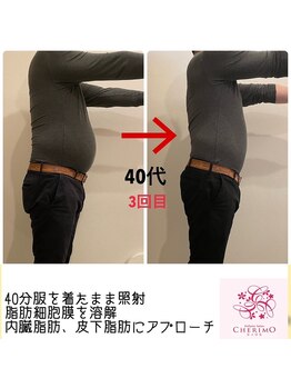 シェリモ(CHERIMO)/温活スリムドーム　3回目　お腹