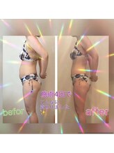 レナトゥス 銀座(Renatus)/4回Before/After痩身/銀座美脚