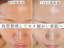 ユウビジン(YOU美人)/