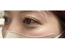 脱毛サロン プレイス(place)