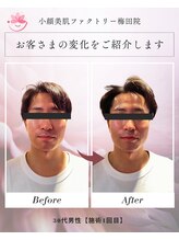 小顔美肌ファクトリー 梅田院/