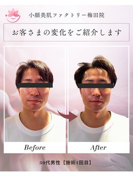 小顔美肌ファクトリー 梅田院/