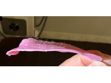 ミカ ネスト(Mika Nest)/お顔ワックス脱毛